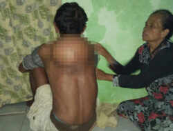 Idap Daging Tumbuh Sebesar Bola Sepak, Warga Majalengka Ini Butuh Bantuan Biaya