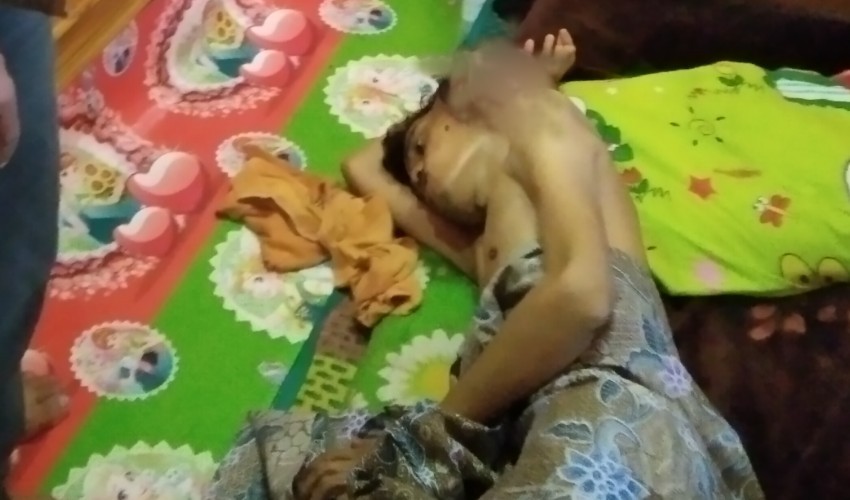Penderita Tumor di Majalengka Butuh Uluran Tangan